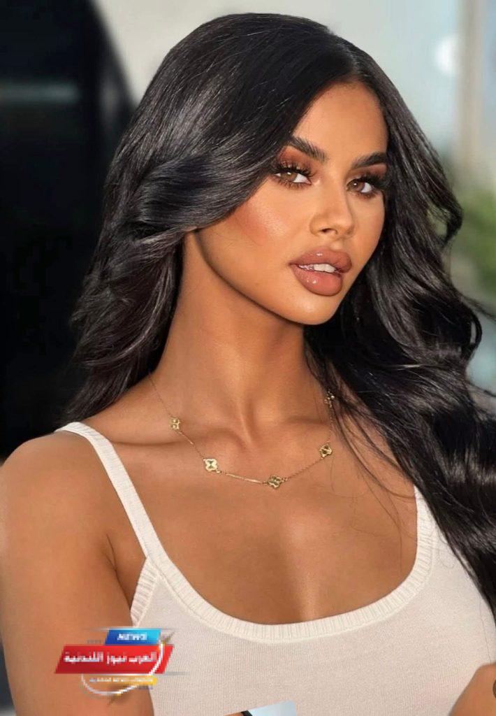 منة عرفة تثير السوشيال ميديا بعد خضوعها لعمليات تجميل