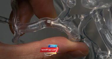 جهاز جديد لقياس تدفق الدم بالدماغ للوقاية من السكتات