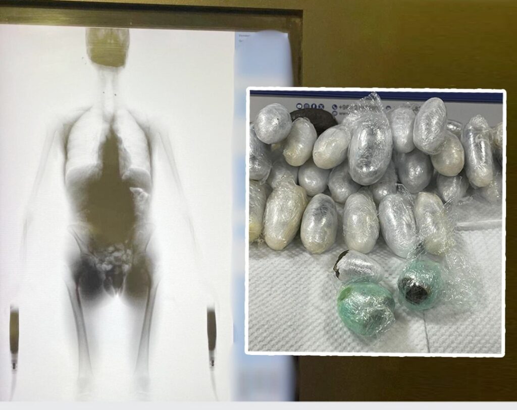 الكويت : إحباط تهريب مخدرات داخل أحشاء مسافر أوروبي قادم من لندن