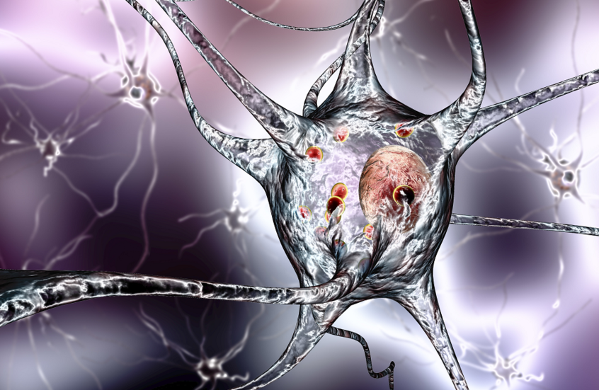 دواء شائع للهربس يزيد تدهور ألزهايمر المبكر