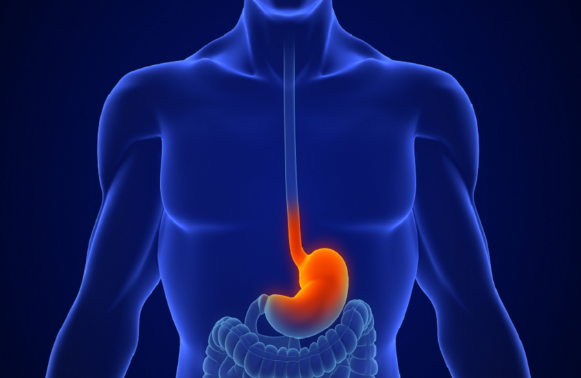دراسة تنفي ارتباط أدوية الحموضة بسرطان المعدة