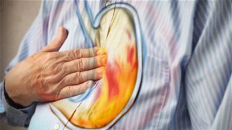 لماذا تزداد حرقة المعدة بعد الإفطار في رمضان؟ أطباء يوضحون الأسباب وطرق الوقاية الفعالة
