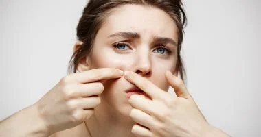 4 وصفات طبيعية للتخلص من البثور قبل مناسباتك المهمة.. والثوم كلمة السر