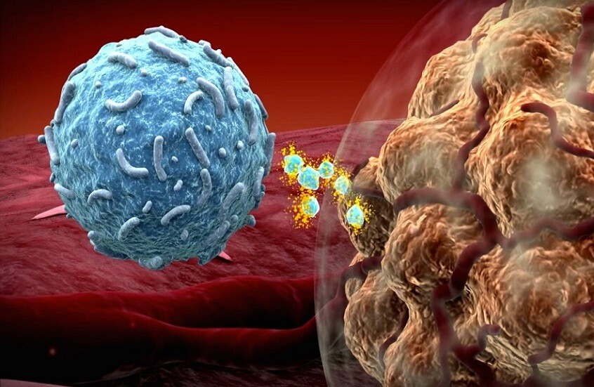 علاج مناعي جديد يستهدف النقائل السرطانية في الدماغ