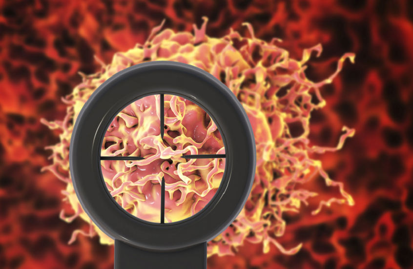 دواء السكري “ميتفورمين” يدعم مرضى سرطان البروستات