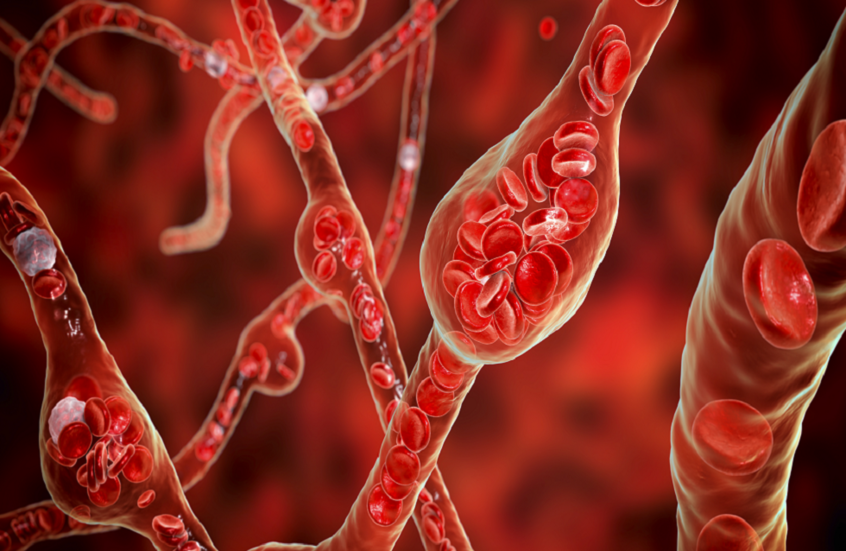 اكتشاف سبب جديد لارتفاع ضغط الدم